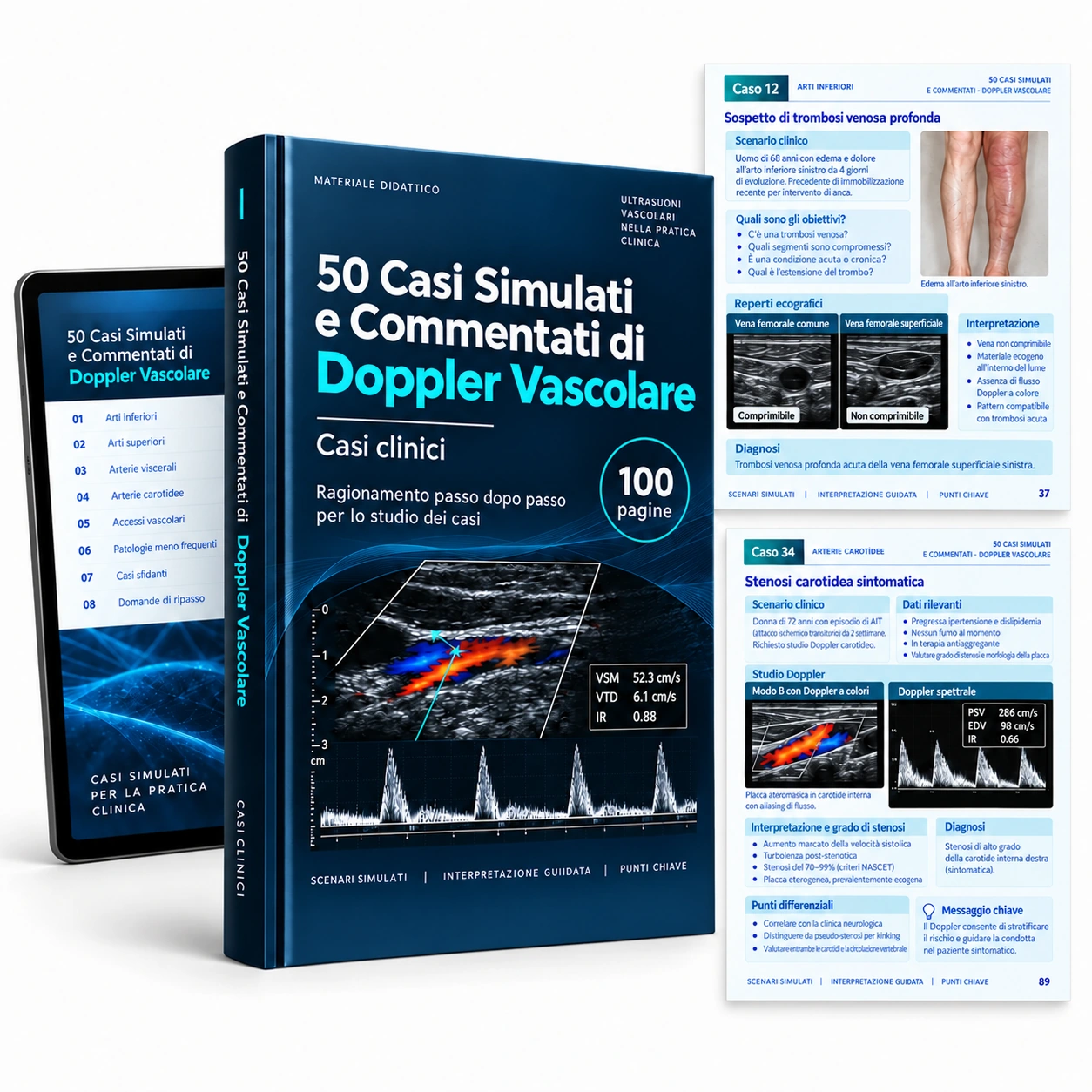 Rappresentazione digitale: 50 Casi Simulati e Commentati di Doppler Vascolare