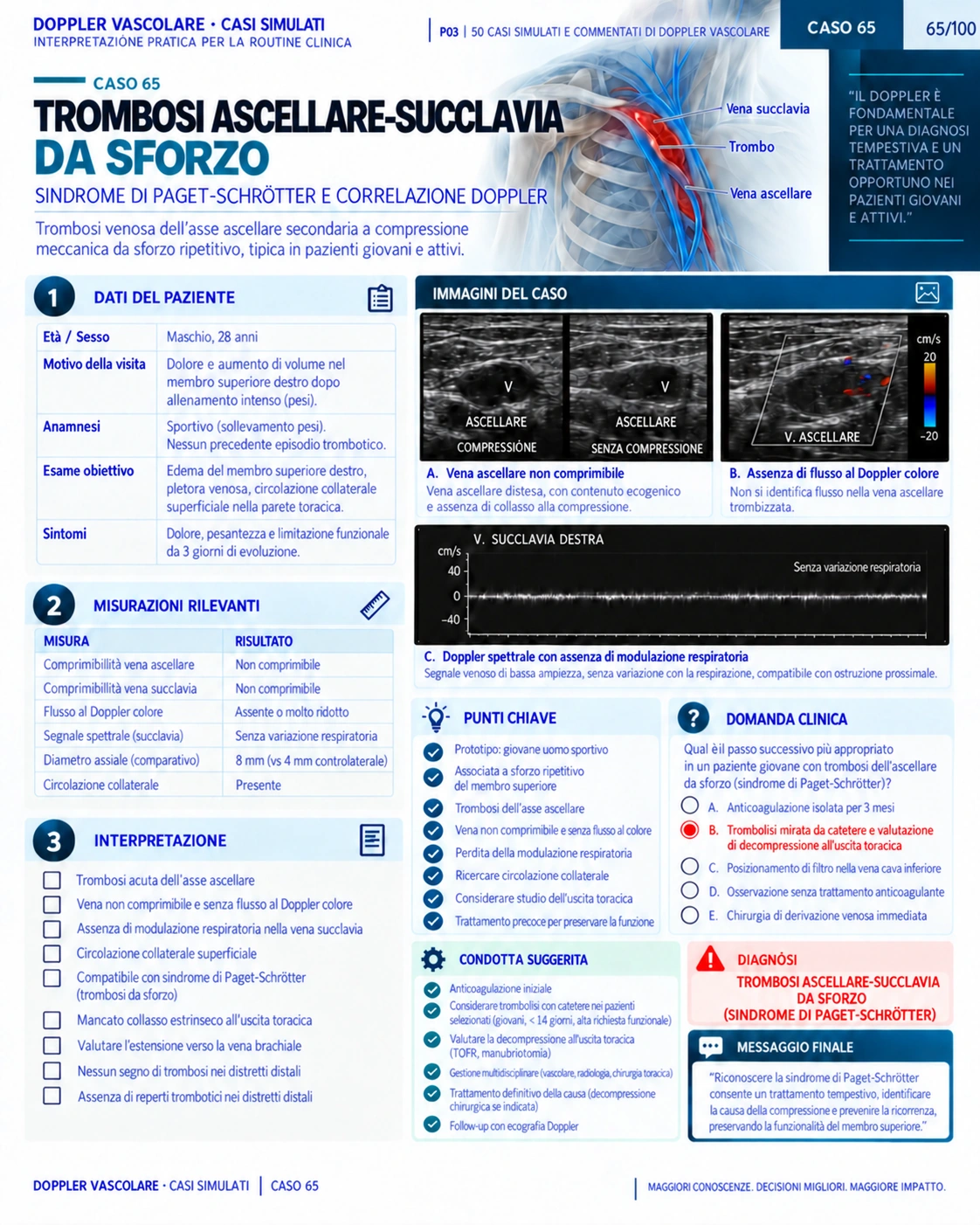 Pagina 65: Caso: trombosi ascellare-succlavia. Anteprima in italiano del materiale di Doppler vascolare.